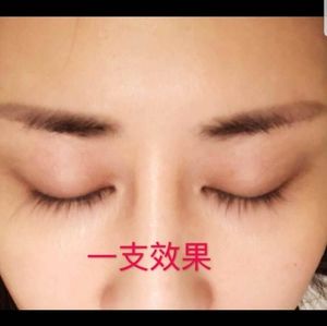 Eyelashes and eyebrows